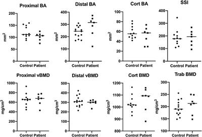 Severe Phenotype of APECED (APS1) Increases Risk for Structural Bone Alterations